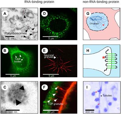 FMRP, a multifunctional RNA-binding protein in quest of a new identity